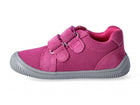 Protetika Dony, fuxia